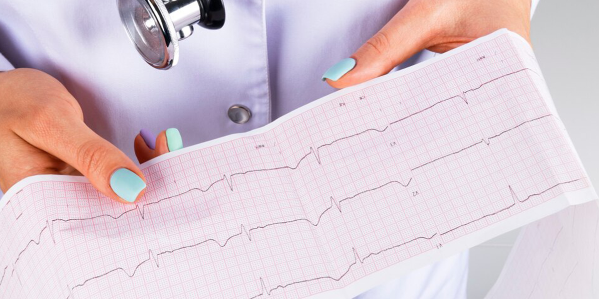 Irregular Heartbeat or Palpitations Irregular Heartbeat or Palpitations
